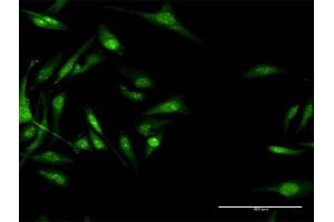 Immunofluorescence of purified MaxPab antibody to CACNB3 on HeLa cell. (CACNB3 Antikörper  (AA 1-484))