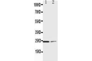 Anti-SOCS1 antibody, Western blotting Lane 1:  Cell Lysate Lane 2: COLO320 Cell Lysate