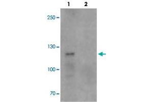 Western blot analysis of TCIRG1 in EL4 cell lysate with TCIRG1 polyclonal antibody  at 0. (TCIRG1 Antikörper  (N-Term))