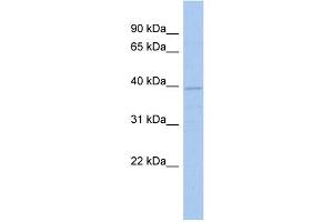 WB Suggested Anti-FLJ33790 Antibody Titration: 0. (FLJ33790 (N-Term) Antikörper)