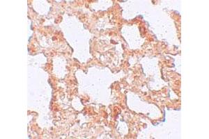 Immunohistochemical staining of rat lung cells with AXIN2 polyclonal antibody  at 5 ug/mL. (AXIN2 Antikörper  (C-Term))