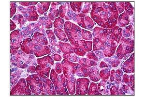 Human Pancreas: Formalin-Fixed, Parraffin-Embedded (FFPE) (Ferredoxin Reductase Antikörper)