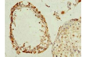 Immunohistochemistry of paraffin-embedded human testis tissue using ABIN7163912 at dilution of 1:100 (KCNRG Antikörper  (AA 1-229))
