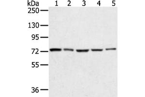 Gel: 6 % SDS-PAGE, Lysate: 40 μg, Lane 1-5: Hela, lncap, skov3, 293T and TM4 cell, Primary antibody: ABIN7131341(TGM4 Antibody) at dilution 1/400 dilution, Secondary antibody: Goat anti rabbit IgG at 1/8000 dilution, Exposure time: 10 seconds (TGM4 Antikörper)