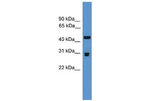 WB Suggested Anti-Pdyn Antibody Titration: 0. (PDYN Antikörper  (Middle Region))