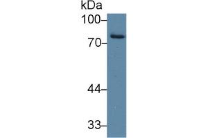 Western blot analysis of Human Placenta lysate, using Human IDS Antibody (2 µg/ml) and HRP-conjugated Goat Anti-Rabbit antibody ( (IDS Antikörper  (AA 95-289))