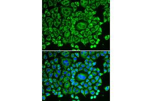 Immunofluorescence analysis of HeLa cells using ARHGDIA antibody (ABIN5970556).