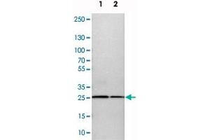 Western blot analysis of cell lysates with CALB2 polyclonal antibody  at 1:250-1:500 dilution.