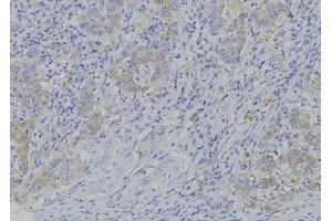 ABIN6273381 at 1/100 staining Human gastric tissue by IHC-P. (PDP2 Antikörper  (N-Term))