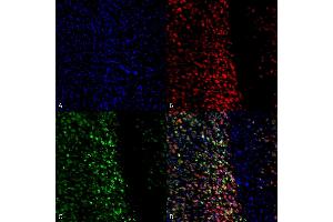 Immunocytochemistry/Immunofluorescence analysis using Rabbit Anti-Alpha Synuclein pSer129 Polyclonal Antibody (ABIN5650939). (SNCA Antikörper  (pSer129) (Atto 488))
