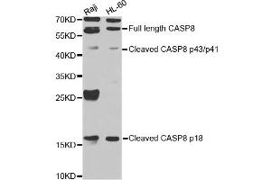Western blot analysis of extracts of various cell lines, using CASP8 antibody. (Caspase 8 Antikörper)