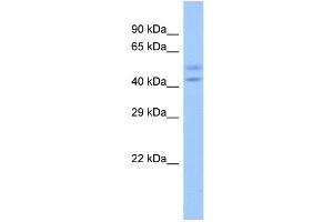 Host:  Rabbit  Target Name:  ZNF679  Sample Type:  Fetal Heart lysates  Antibody Dilution:  1. (ZNF679 Antikörper  (N-Term))