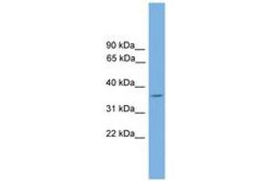 Image no. 1 for anti-DnaJ (Hsp40) Homolog, Subfamily C, Member 17 (DNAJC17) (AA 151-200) antibody (ABIN6744622) (DNAJC17 Antikörper  (AA 151-200))
