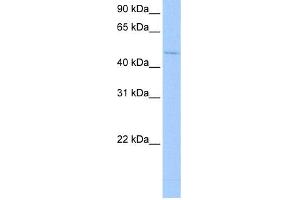 WB Suggested Anti-RBM45 Antibody  Titration: 0. (RBM45 Antikörper  (Middle Region))