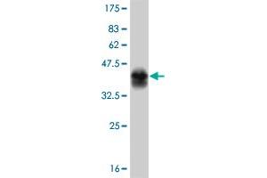 Western Blotting (WB) image for anti-Tyrosine Kinase 2 (TYK2) (AA 276-375) antibody (ABIN563303)