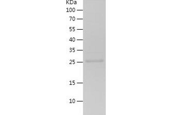 Endothelin 1 Protein (EDN1) (AA 53-90) (His-IF2DI Tag)