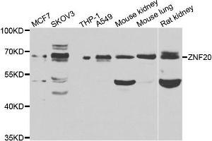Western blot analysis of extracts of various cell lines, using ZNF20 antibody. (ZNF20 Antikörper)