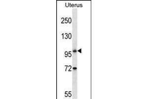 ATG9B Antibody (C-term) (ABIN657572 and ABIN2846578) western blot analysis in human normal Uterus tissue lysates (35 μg/lane).