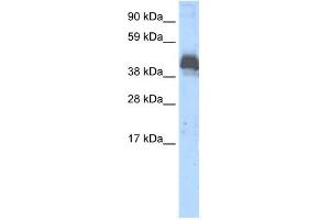 WB Suggested Anti-ZNF297B Antibody Titration:  0. (ZBTB43 Antikörper  (Middle Region))