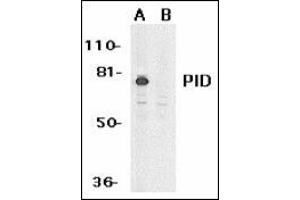 Western blot analysis of PID expression in HeLa whole cell lysates in the absence (A) or presence (B) of blocking peptide with this product at 1 μg /ml.