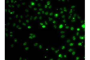 Immunofluorescence analysis of MCF-7 cells using RSRC1 antibody (ABIN6131423, ABIN6147283, ABIN6147284 and ABIN6223040).