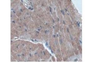IHC-P analysis of Rat Heart Tissue, with DAB staining. (ORM1 Antikörper  (AA 20-186))
