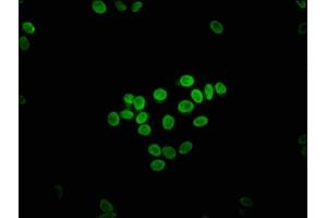 Immunofluorescence staining of HepG2 cells with ABIN7152078 at 1:133, counter-stained with DAPI. (ETV2 Antikörper  (AA 74-201))