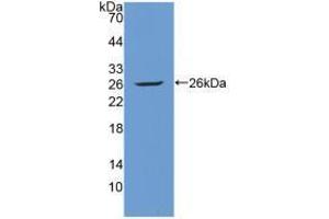 Western blot analysis of recombinant Human Tie1. (TIE1 Antikörper  (AA 701-898))