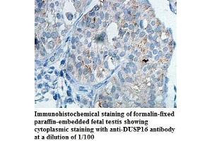 Image no. 1 for anti-Dual Specificity Phosphatase 16 (DUSP16) antibody (ABIN1576133) (DUSP16 Antikörper)