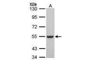 Image no. 1 for anti-Retinoid X Receptor, beta (RXRB) (AA 20-83) antibody (ABIN467472) (Retinoid X Receptor beta Antikörper  (AA 20-83))
