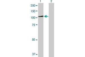 Western Blot analysis of MTHFD1 expression in transfected 293T cell line by MTHFD1 MaxPab polyclonal antibody. (MTHFD1 Antikörper  (AA 1-935))
