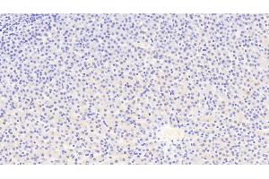 Detection of ATG16L1 in Human Liver Tissue using Polyclonal Antibody to Autophagy Related Protein 16 Like Protein 1 (ATG16L1) (ATG16L1 Antikörper  (AA 342-607))