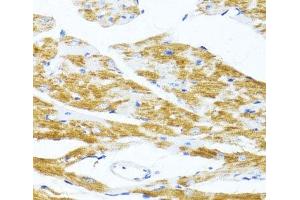 Immunohistochemistry of paraffin-embedded Mouse heart using MS4A8B Polyclonal Antibody at dilution of 1:100 (40x lens). (Membrane-Spanning 4-Domains, Subfamily A, Member 8 (MS4A8) Antikörper)