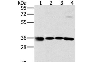 Western Blot analysis of 293T, K562, 231 and hela cell using MRPL39 Polyclonal Antibody at dilution of 1:600 (MRPL39 Antikörper)