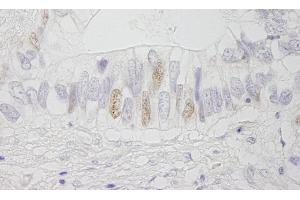 Immunohistochemistry (IHC) image for anti-Adenomatous Polyposis Coli (APC) (AA 1-50) antibody (ABIN7448412)