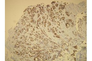 Immunohistochemistry (IHC) image for anti-Keratin 7 (KRT7) (AA 22-38), (N-Term) antibody (ABIN870438) (Cytokeratin 7 Antikörper  (N-Term))