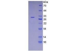 SDS-PAGE analysis of Mouse RIPK3 Protein. (RIPK3 Protein)