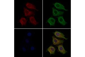 ABIN6257439 and ABIN6276207 staining Hela cells by IF/ICC. (PRLHR Antikörper  (Internal Region))