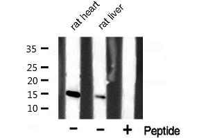 Western blot analysis of extracts of various celllines,using p15 INK Antibody. (CDKN2B Antikörper  (Internal Region))