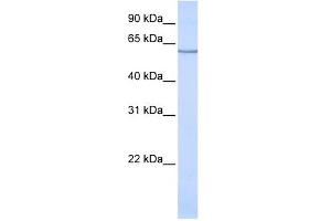 SLC1A1 antibody used at 1 ug/ml to detect target protein. (SLC1A1 Antikörper  (N-Term))