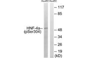 Western blot analysis of extracts from HuvEc cells treated with EGF 200ng/ml 30', using HNF4 alpha (Phospho-Ser313) Antibody. (HNF4A Antikörper  (pSer313))