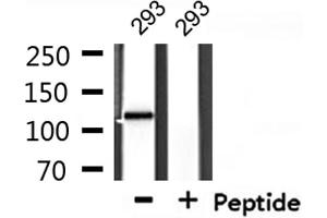 Western Blotting (WB) image for anti-Caspase Recruitment Domain Family, Member 6 (CARD6) (N-Term) antibody (ABIN6260460)