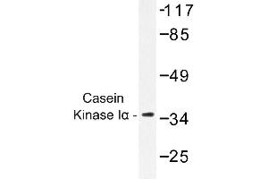 Image no. 1 for anti-Casein Kinase 1, alpha 1 (CSNK1A1) antibody (ABIN272195) (CSNK1A1 Antikörper)