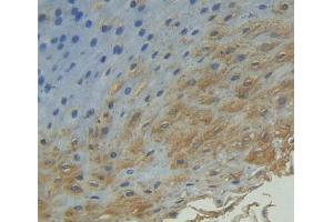 IHC-P analysis of Human Tissue, with DAB staining. (Cyclin B2 Antikörper  (AA 58-398))
