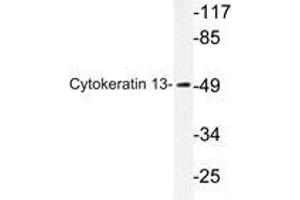 Western blot analysis of Cytokeratin 13 antibody in extracts from HepG2 cells. (Cytokeratin 13 Antikörper)