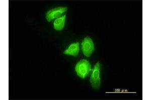 Immunofluorescence of monoclonal antibody to DNAJC3 on HeLa cell. (DNAJC3 Antikörper  (AA 1-234))