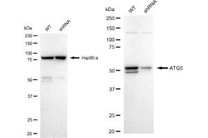 Western blotting analysis using ATG5 antibody (ABIN7797674). (Rekombinanter ATG5 Antikörper)
