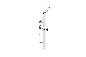 Western Blot at 1:16000 dilution + SK-BR-3 whole cell lysate Lysates/proteins at 20 ug per lane. (DERL1 Antikörper  (C-Term))