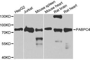 Western blot analysis of extracts of various cell lines, using PABPC4 antibody (ABIN5973544) at 1/1000 dilution. (PABPC4 Antikörper)