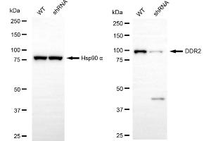anti-Discoidin Domain Receptor tyrosine Kinase 2 (DDR2) antibody